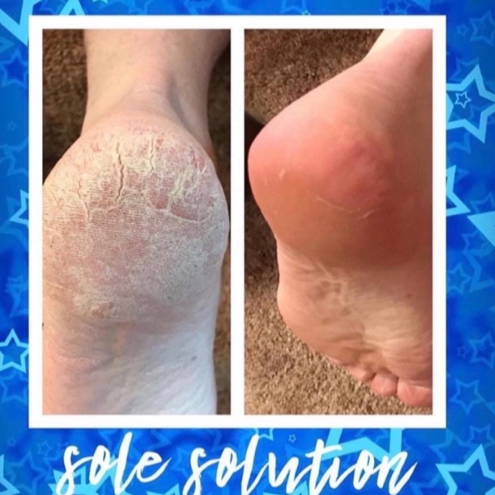- (2) TWO Epoch NuSkin Sole Solution foot treatment